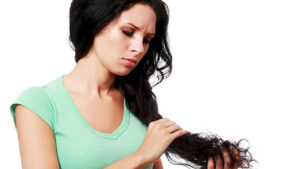 Hair Loss Before Wedding