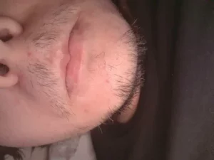 Beardless