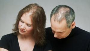 Hair Loss Before Wedding