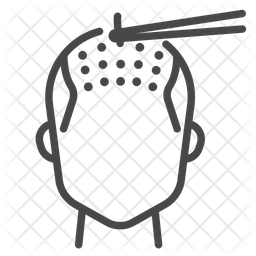 Saç Ekim Fiyatları Bilgilendirme